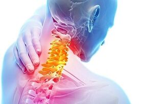 príčiny krčnej osteochondrózy